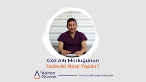 Göz Altı Morluğunun Tedavisi Nasıl Yapılır?
