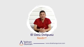 El Üstü Dolgusu Nedir?